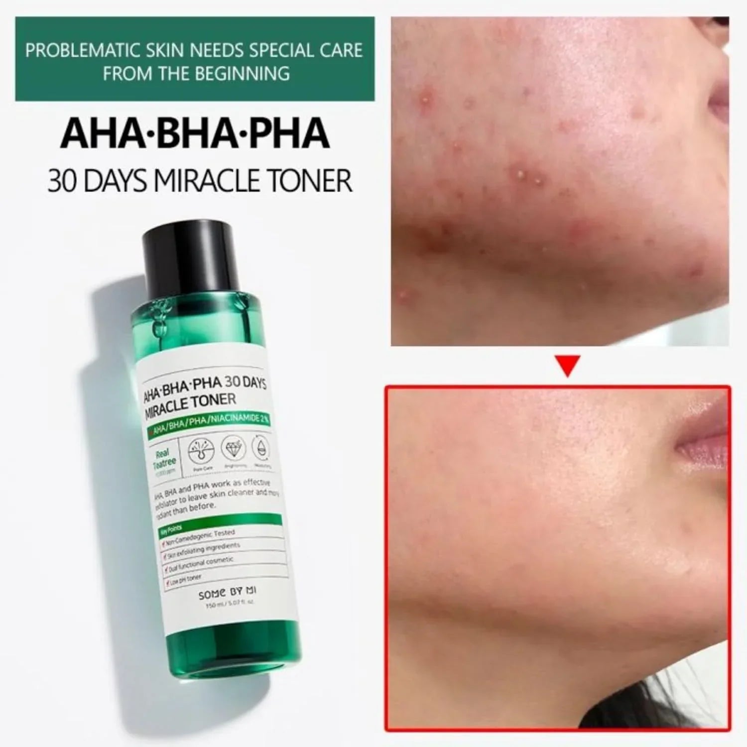 SOME BY MI AHA BHA PHA 30 Days Miracle Toner – Clear, Smooth & Radiant Skin