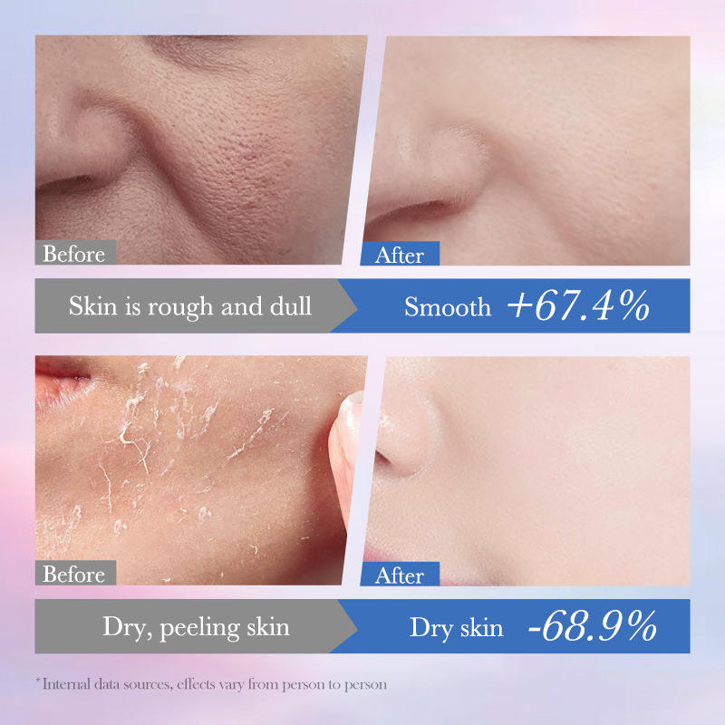 SADOER 10% Niacinamide Spot Removal Repair Lotion