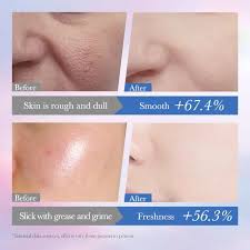 SADOER 10% Niacinamide Spot Removal Gentle Cleanser – Brighten, Cleanse & Clarify