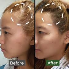 SOME BY MI Cica Peptide Anti Hair Loss Derma Scalp Tonic – Soothe, Strengthen & Revitalize