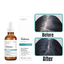 The Ordinary Multi-Peptide Serum for Hair Density