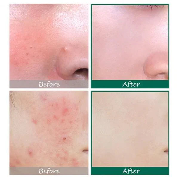 SOME BY MI AHA BHA PHA 30 Days Miracle Serum – Clear, Smooth & Balanced Skin